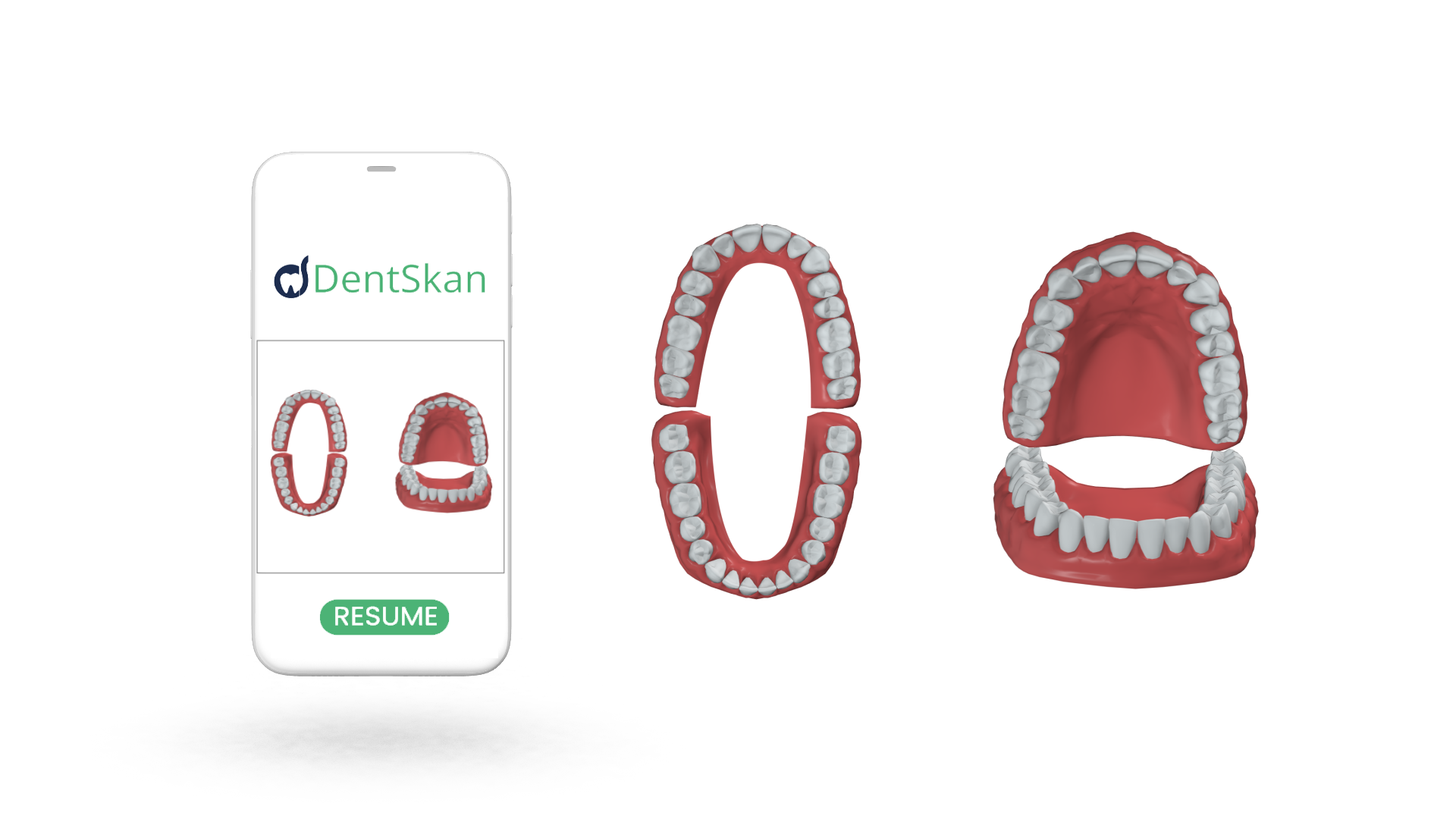 Dentskan Revolutionizing At Home Dental Impressions